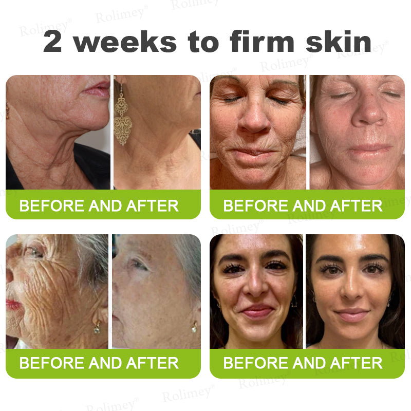 Rolimey Botox & Vita A Retinol Shot Wrinkle-Lift Tightening cream