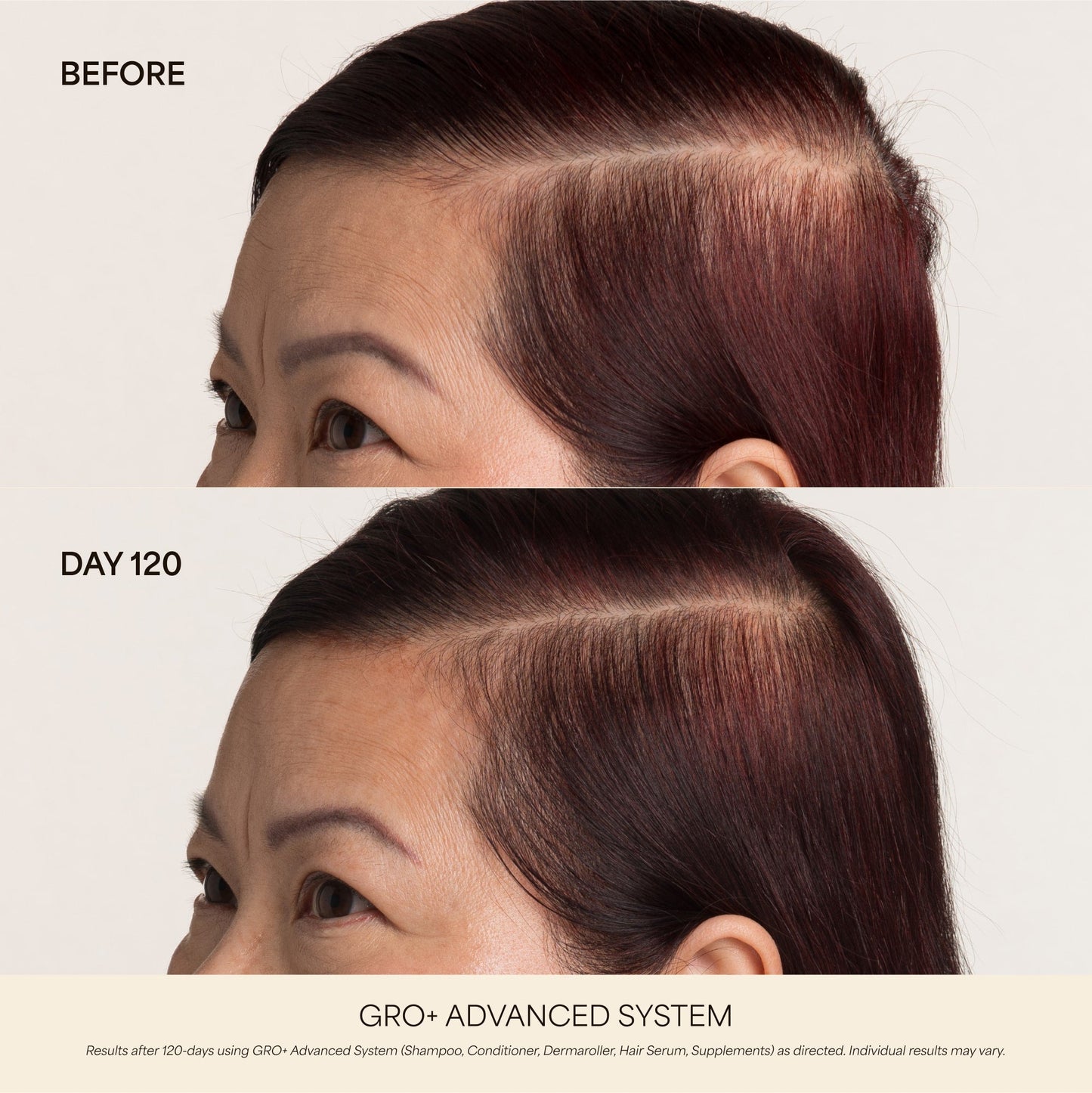 GRO+ Advanced Hair Serum 1oz