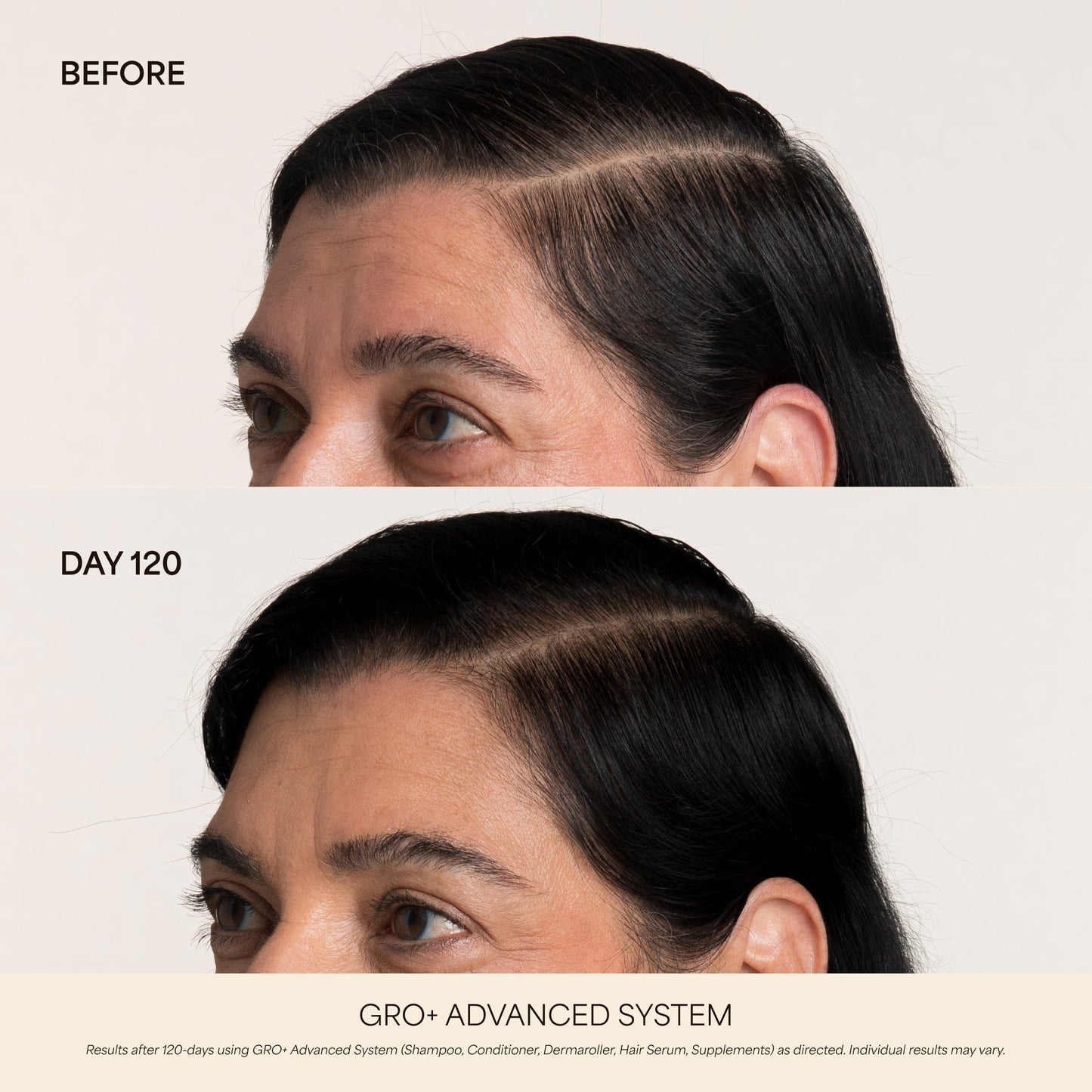GRO+ Advanced Hair Serum 1oz