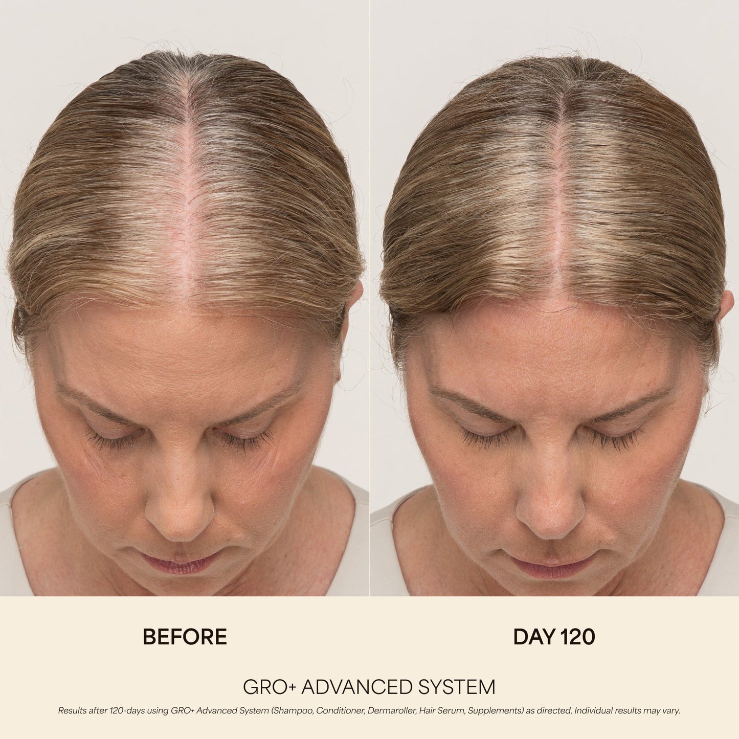 GRO+ Advanced Hair Serum 1oz