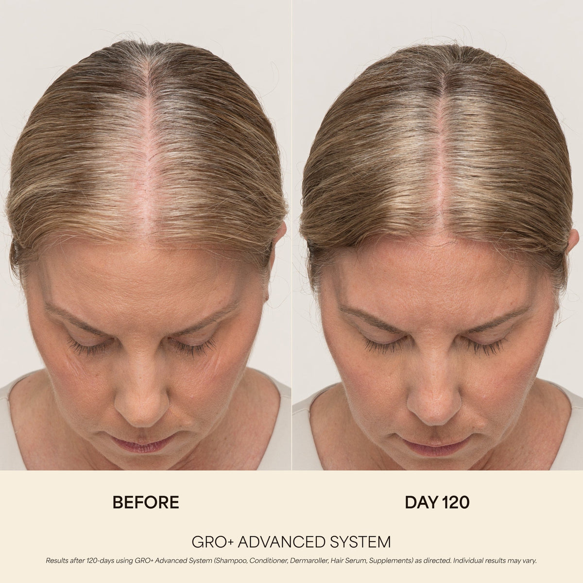 GRO+ Advanced Hair Serum 1oz