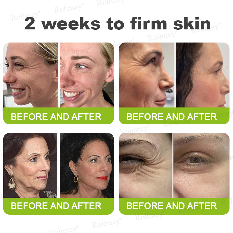 Rolimey Botox & Vita A Retinol Shot Wrinkle-Lift Tightening cream