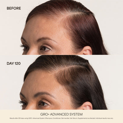 GRO+ Advanced Hair Serum 1oz