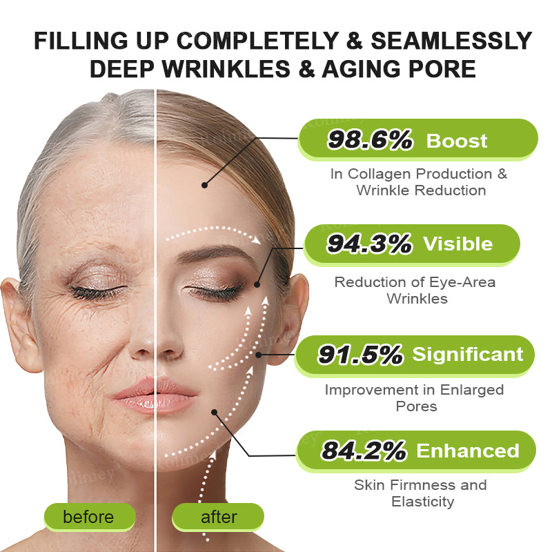 Rolimey Botox & Vita A Retinol Shot Wrinkle-Lift Tightening cream
