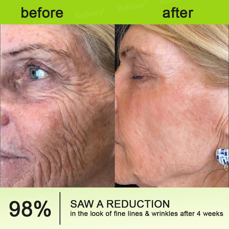 Rolimey Botox & Vita A Retinol Shot Wrinkle-Lift Tightening cream