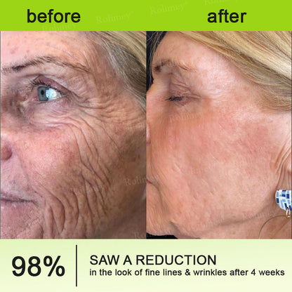 Rolimey Botox & Vita A Retinol Shot Wrinkle-Lift Tightening cream