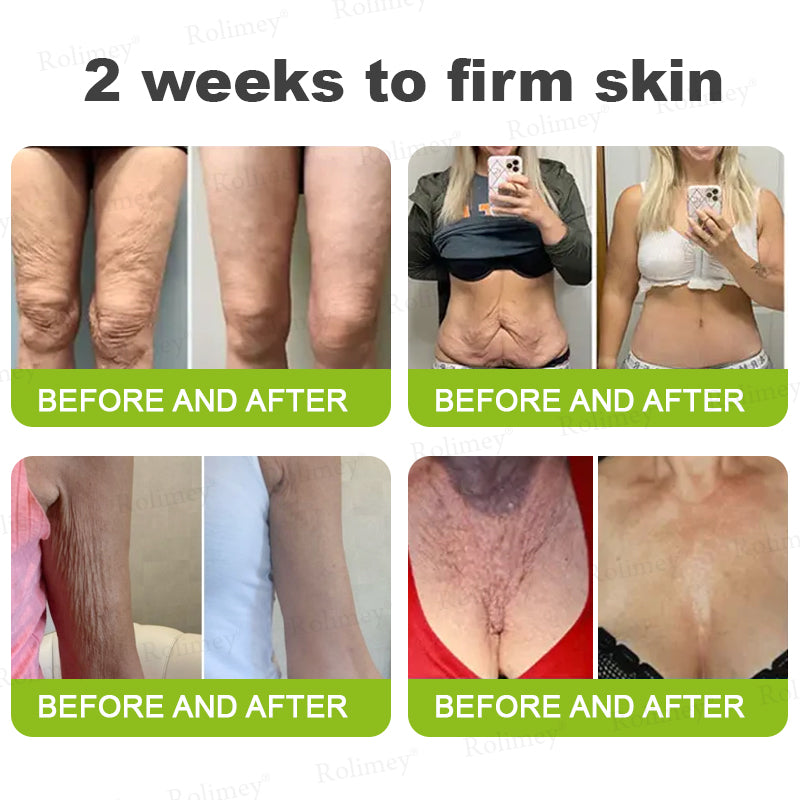 Rolimey Botox & Vita A Retinol Shot Wrinkle-Lift Tightening cream
