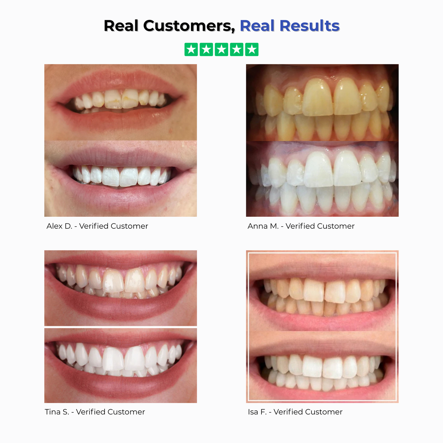 Purple Teeth whitening Strips