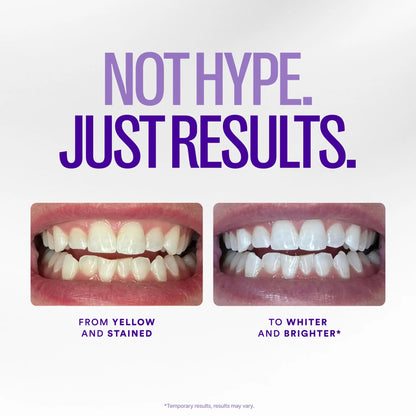 Hismile V34 Whitening Strips, Tooth Stain Treatment, Combining Whitening and Colour Correction