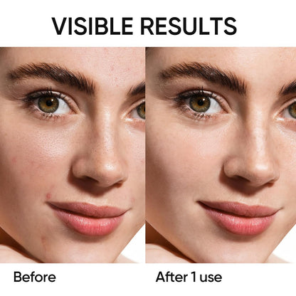 Clay Stick Mask – Deep Pore Cleansing, Oil Control & Brightening Care