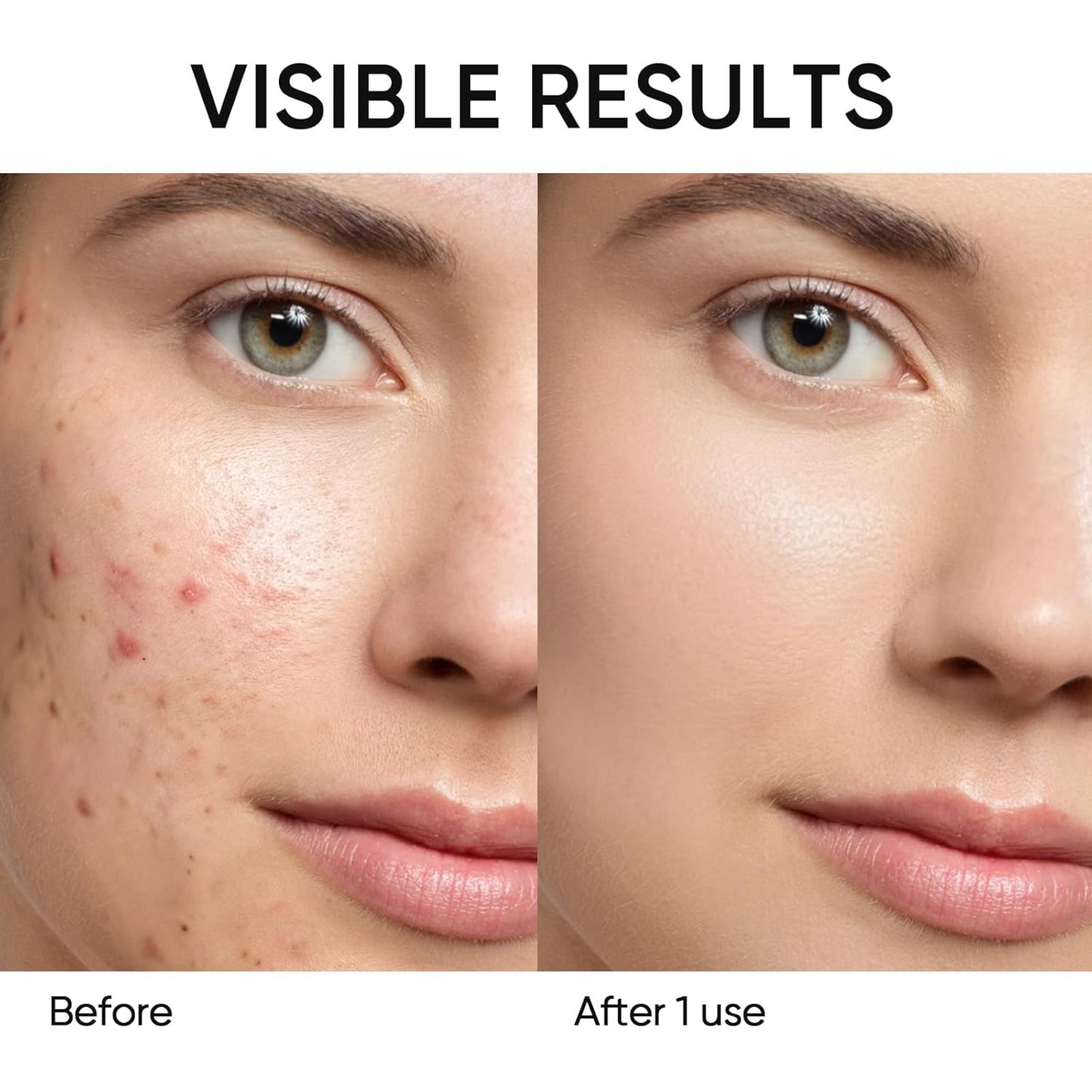 Clay Stick Mask – Deep Pore Cleansing, Oil Control & Brightening Care