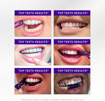 Hismile V34 Whitening Strips, Tooth Stain Treatment, Combining Whitening and Colour Correction