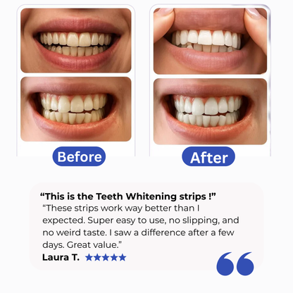 Purple Teeth whitening Strips