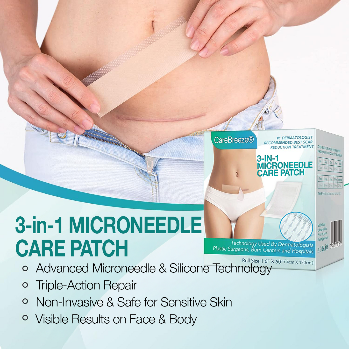 3 in 1 Microdarts Care Patch, 2026 New Professional Silicone Scar Sheets