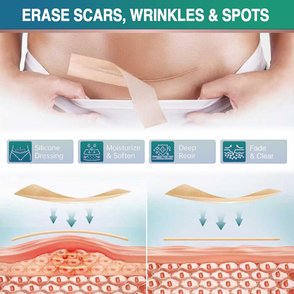 3 in 1 Microdarts Care Patch, 2026 New Professional Silicone Scar Sheets
